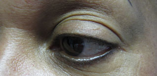 Edda Garcia Permanent Makeup Eyeliner Procedure