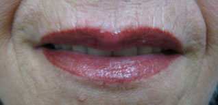 Edda Garcia Permanent makeup Lip Liner Procedure